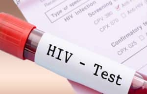 HIV test