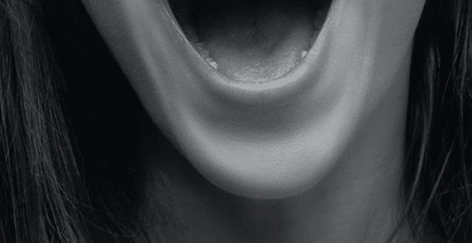 mond1