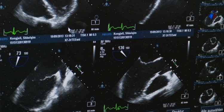 ultrasound 509396 1280