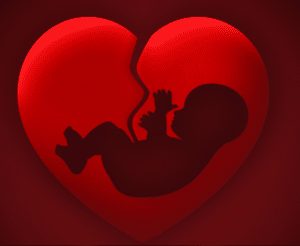 abortus | GFC Nieuws