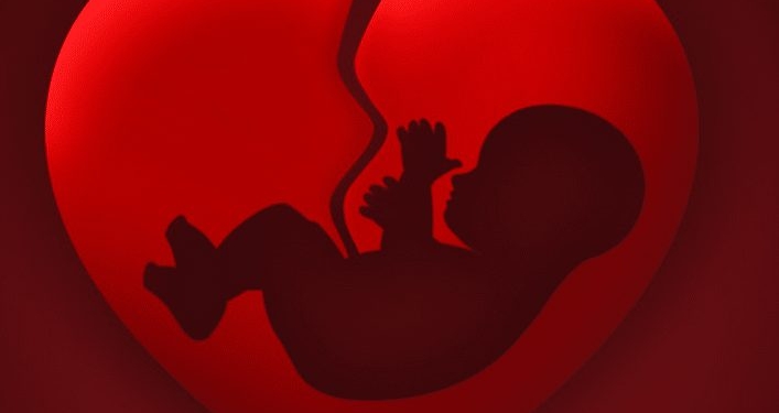 abortus