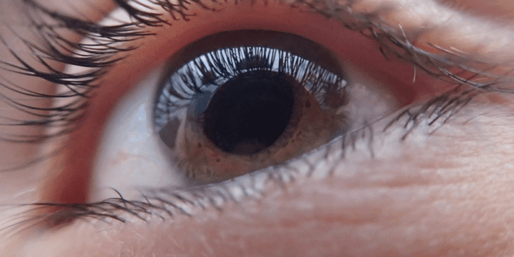 oog1 vrouw