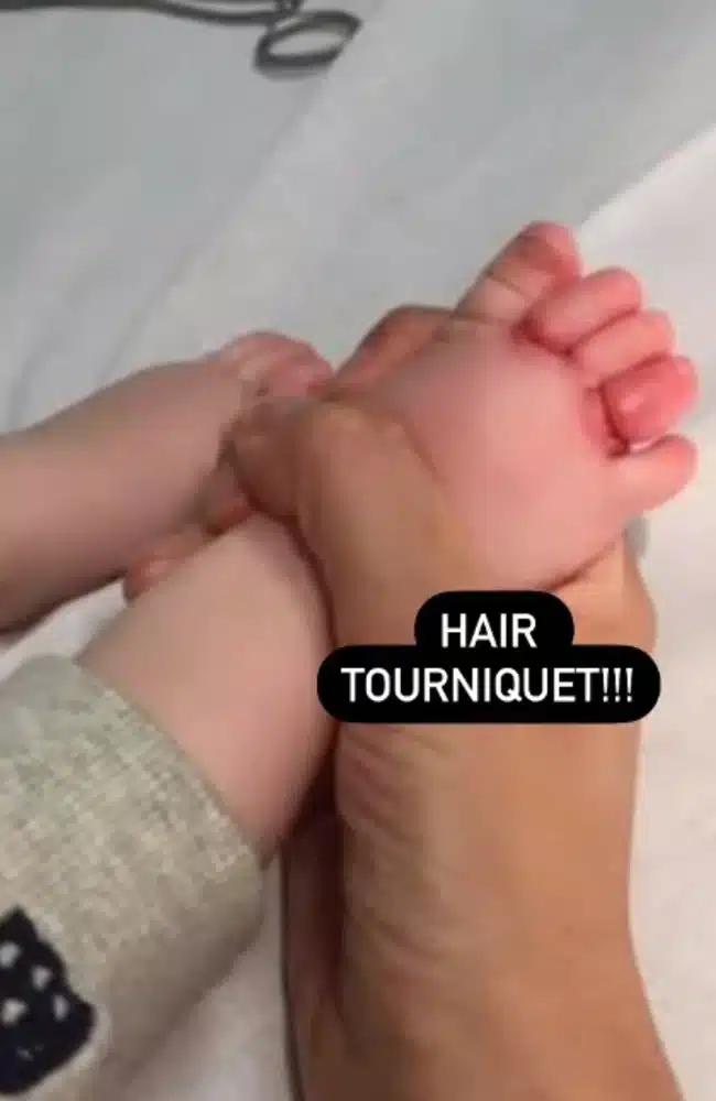 Waarschuwing experts: losse haardeeltjes gevaarlijk voor baby’s