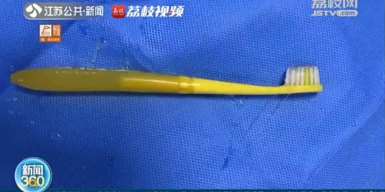swallowed toothbrush 750x421 1