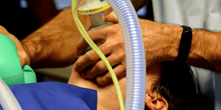 icu beademing