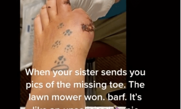 toe