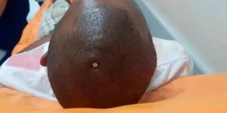 1636307193551