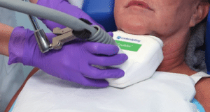 coolsculpting | GFC