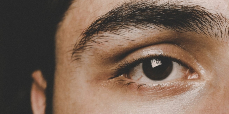 man oog