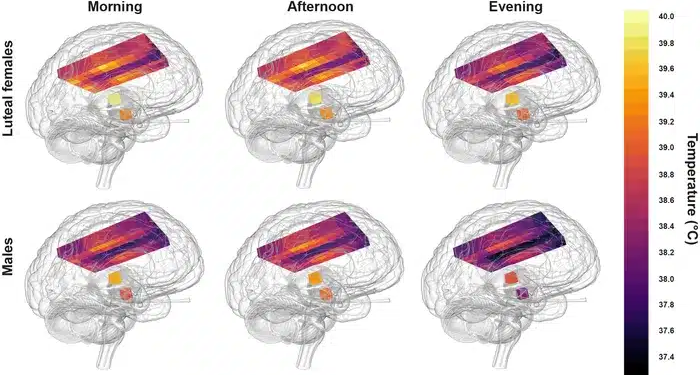 Healthy Human Brain Temperatures