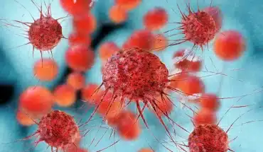 Nieuw risicovol subtype van kanker ontdekt 17 KANKERCELLEN VIRUS | GFC Nieuws