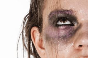 geweld slaan vrouw | GFC Nieuws