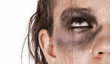 geweld slaan vrouw | GFC Nieuws
