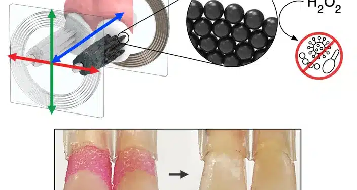 Microrobots Teeth