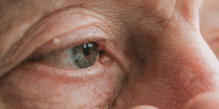 man oog