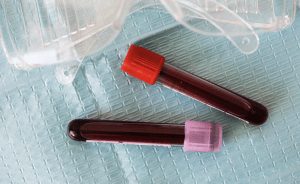 bloedonderzoek | GFC Nieuws