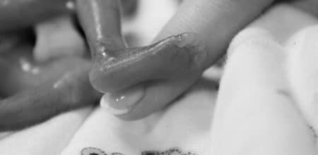 Foetus
