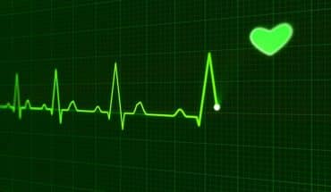 ECG hartfilmpje