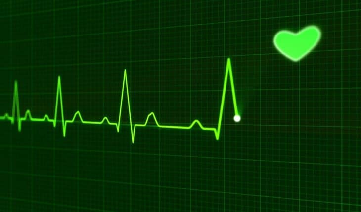 ECG hartfilmpje