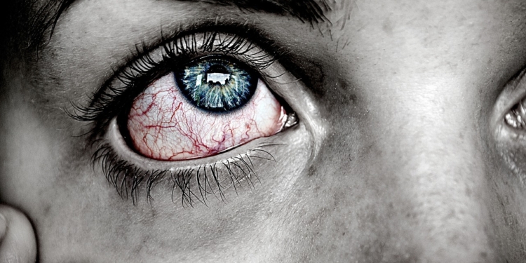 Ziek vrouw oog