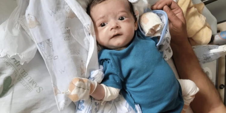 Theo