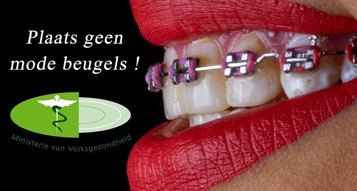 beugels