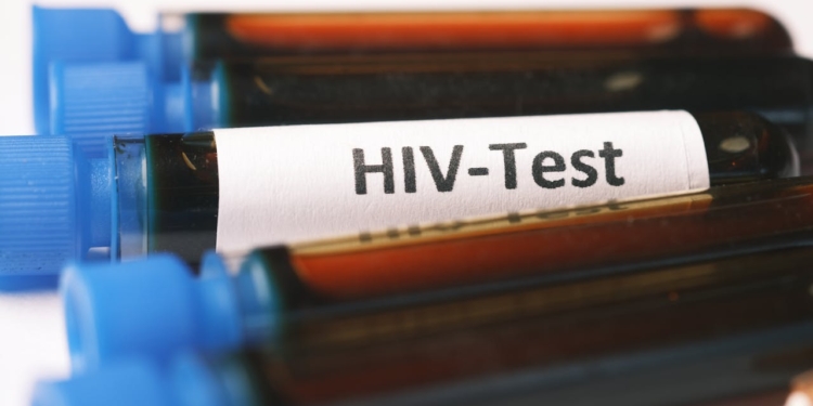 HIV