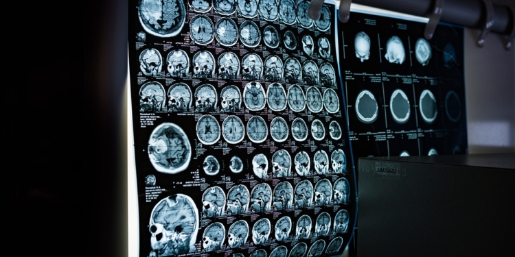 MRI CT