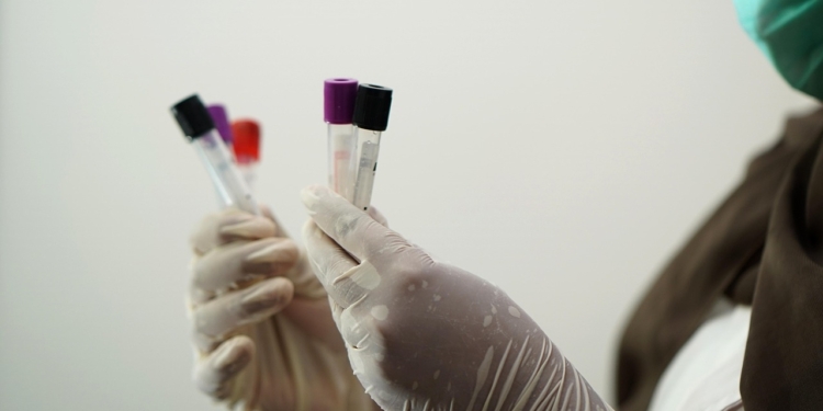 Laboratorium lab bloedonderzoek