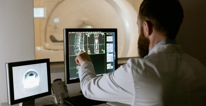 Echografie