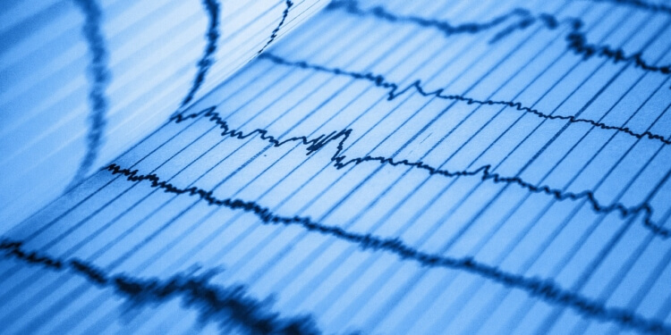 ECG