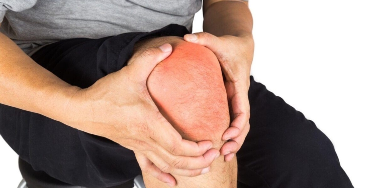 Knie