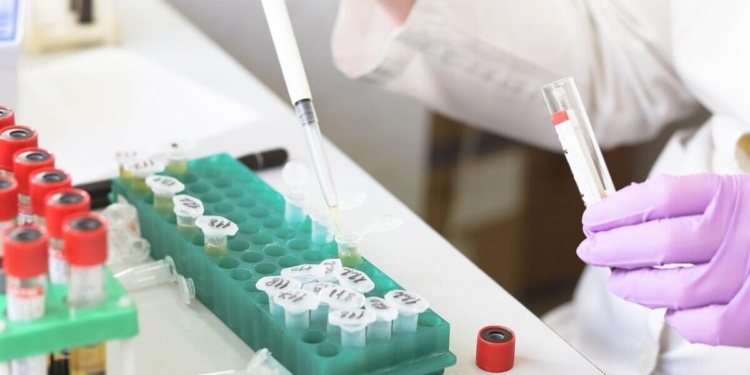 Laboratorium onderzoek