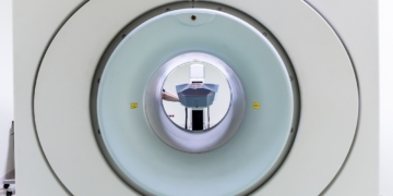 Patiënten weten niet meer wat een MRI-scan werkelijk kost